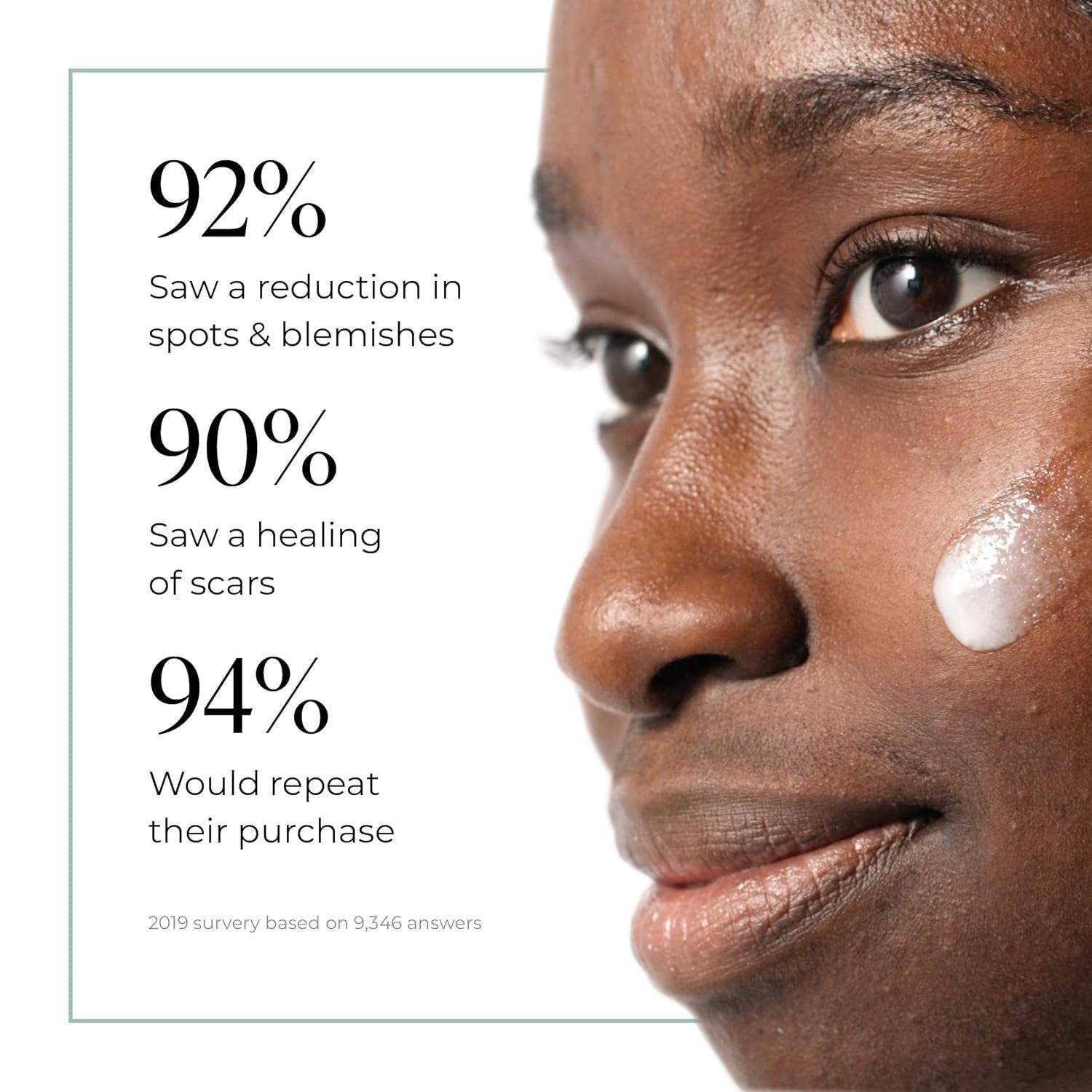 Moisturizing Anti-Acne Facial Serum
